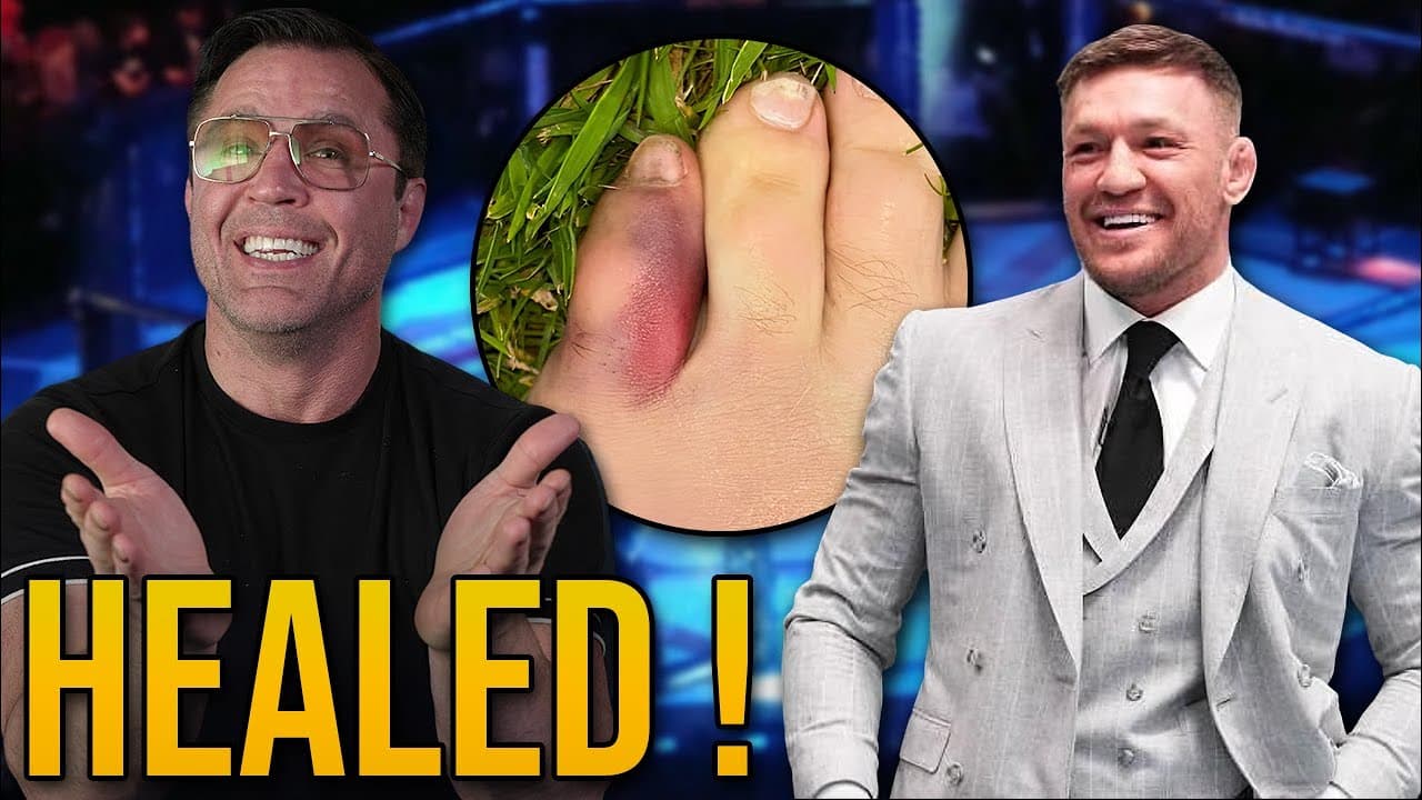 Conor McGregor says the Pinky Toe is Healed!